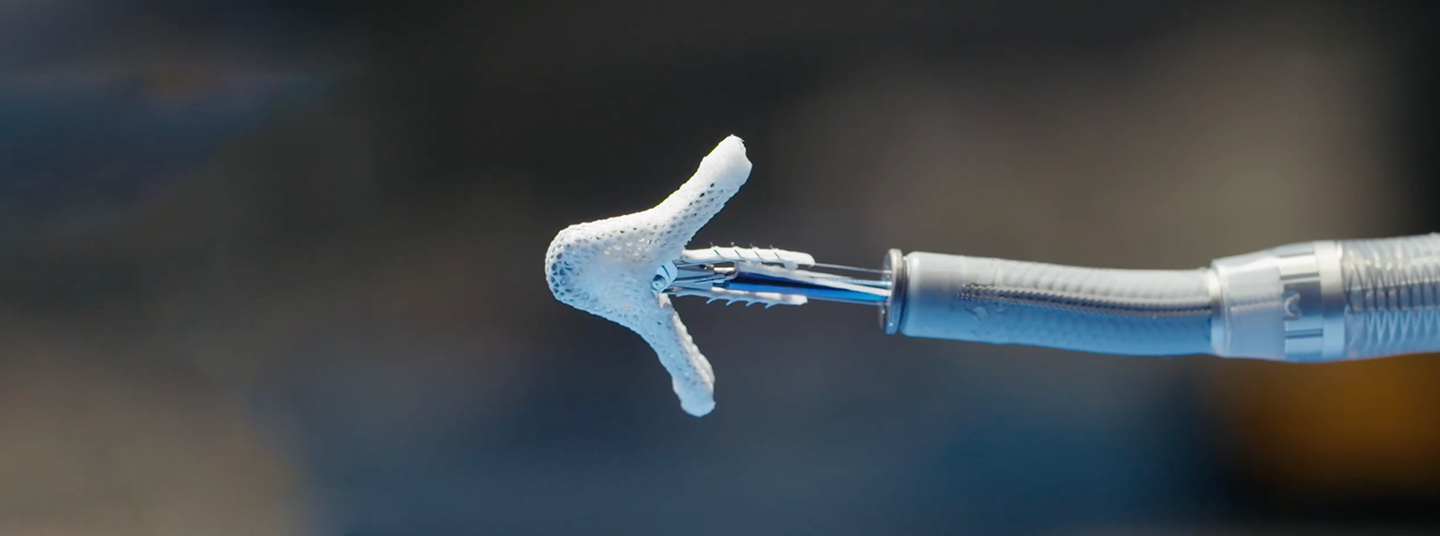 New Clip Delivery System for Non-Invasive Treatment of Leaky Mitral Valves