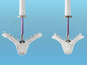 Mitraclip: Helping more people than ever