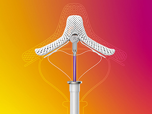 MitraClip Named 2020 Best Medical Technology