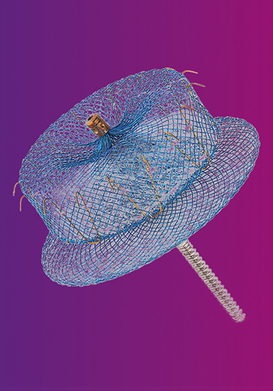 AMULET BRINGS COMPETITION TO KEY DEVICE MARKET